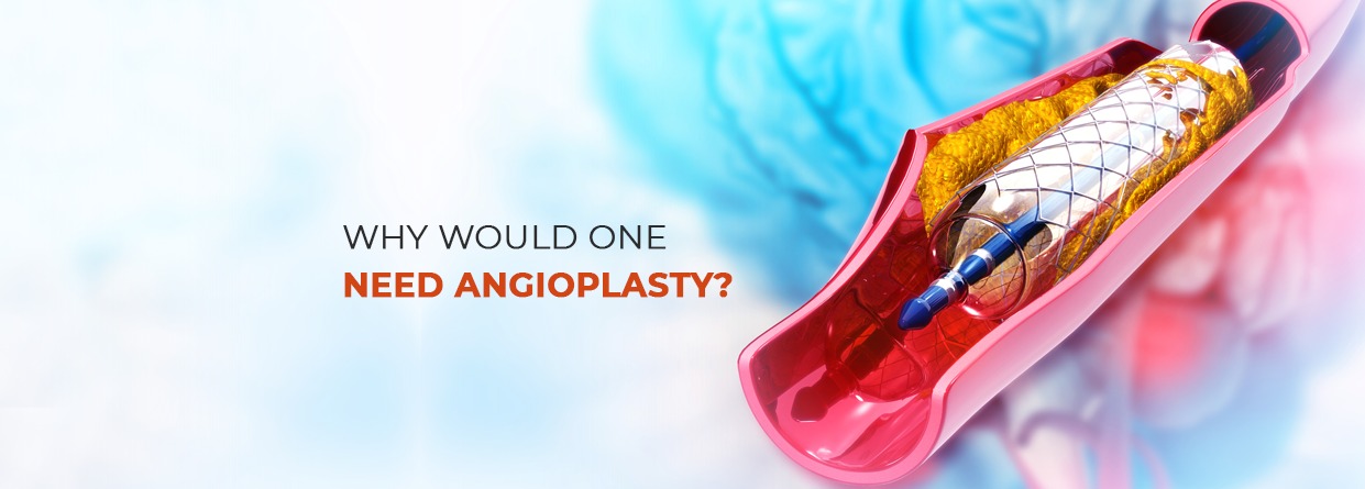 Why Would One Need Angioplasty?